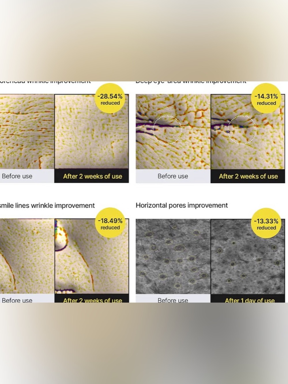 New! Vita A Retinal Shot Tightening Booster | 0.1% Retinal, 3% Matryxyl, - Picture 4 of 8